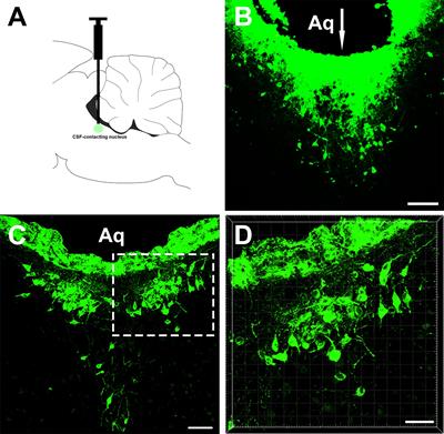 The CSF-Contacting Nucleus Receives Anatomical Inputs From the Cerebral Cortex: A Combination of Retrograde Tracing and 3D Reconstruction Study in Rat